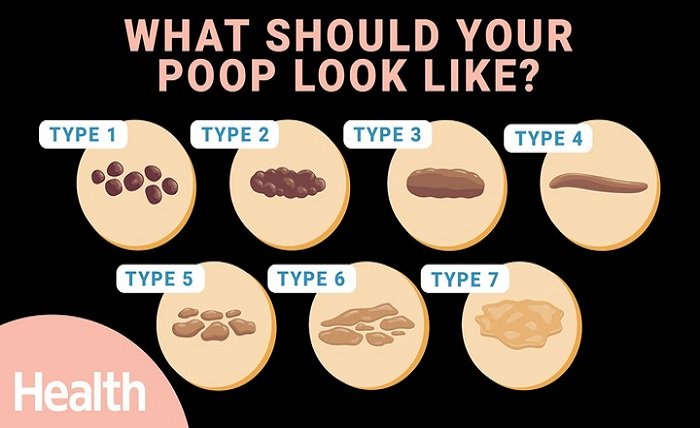 Diabetic Poop